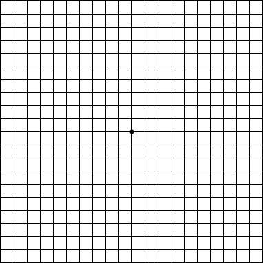 Amsler Grid Test | California Retina Consultants™